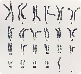 Fotografia. Há 22 pares de cromossomos numerados e organizados em ordem decrescente de tamanho. Eles apresentam formato de filamentos espessos, com alguns deles curvos. Ao final, há um filamento grande indicado com a letra X, e ao lado, um espaço indicado com a letra Y sem nenhum cromossomo.