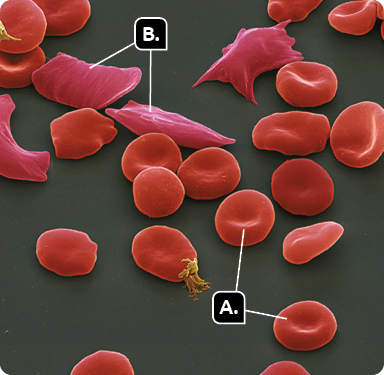 Fotografia de estruturas vermelhas com formato de disco bicôncavo, indicadas com a letra A; e estruturas rosadas com formatos irregulares, indicadas pela letra B.