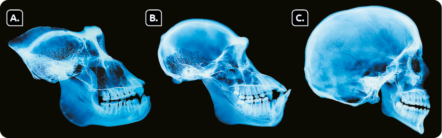 Fotografia de três radiografias, imagem azul em fundo preto. Radiografia A, do crânio de um gorila, com ossos da mandíbula e maxila bem desenvolvidos com dentes e região encefálica pequena. Radiografia B, do crânio de um chimpanzé, com ossos da mandíbula e maxila bem desenvolvidos com dentes e região encefálica mais desenvolvida. Radiografia C, do crânio de um ser humano, com ossos da mandíbula e maxila menores com dentes e região encefálica bem desenvolvida.