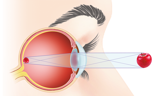 Ilustração em corte do olho de uma pessoa que está de perfil. Há uma maçã na frente do olho, de onde são representadas linhas que saem de suas extremidades, passam por uma estrutura circular do olho, similar a uma lente biconvexa, e chegam até a outra extremidade do globo ocular. Nela a maçã está representada com tamanho menor e de ponta cabeça.