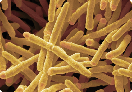 Fotografia do zoom microscópico de uma bactéria - Mycobacterium tuberculosis. Semelhante a vários tubos cilíondricos compridos e finos, estão uns em cima dos outros. 