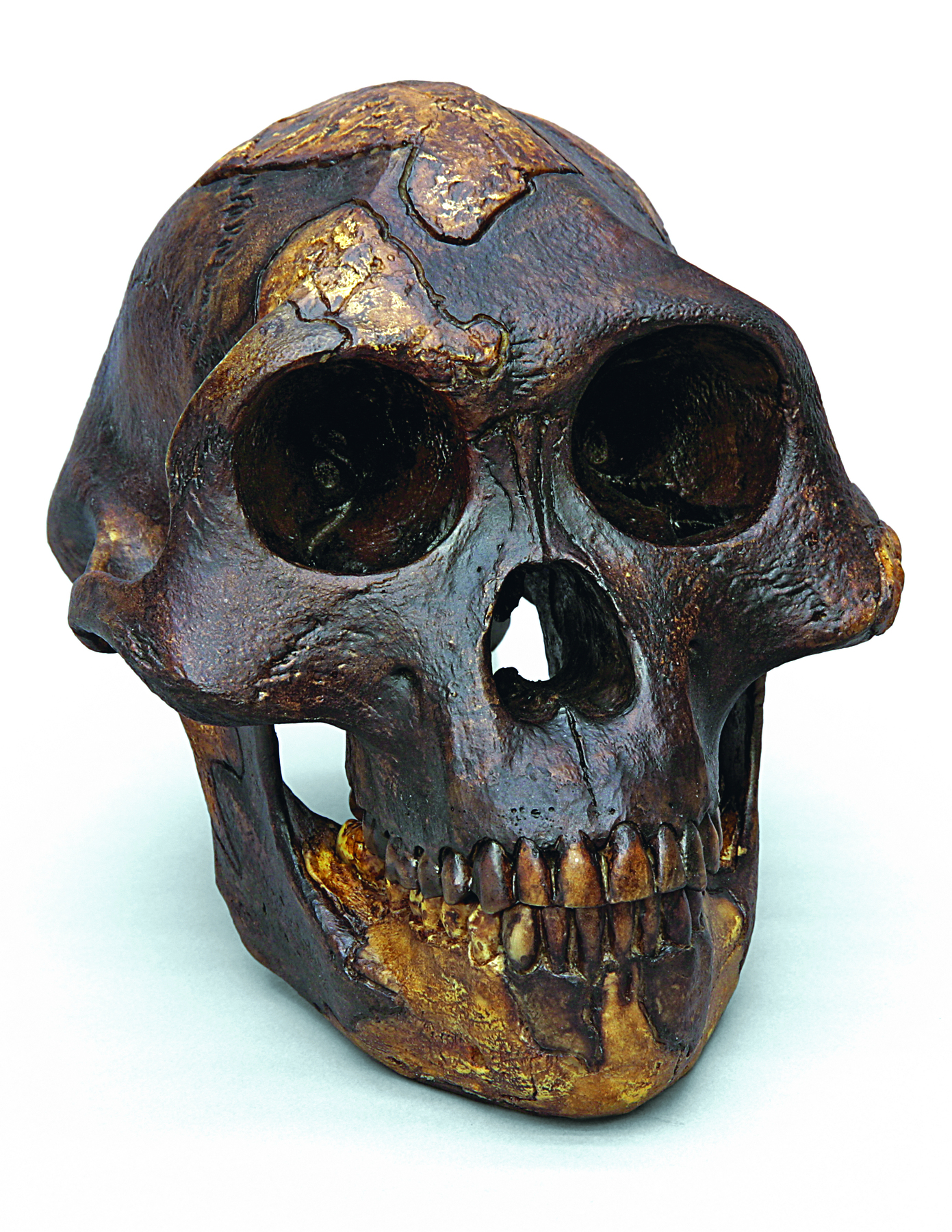 Fotografia. Crânio visto de frente, com dentes na boca, e partes com coloração diferente, indicando que foram reconstituídas, no topo da cabeça, acima de um dos olhos, no queixo e nos dentes.